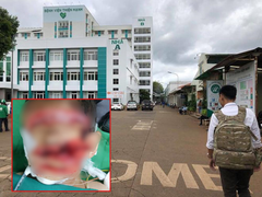 Mẹ bỏ nhà đi, cha chém con trai 5 tuổi nguy kịch