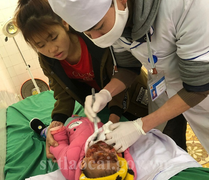 Bé 11 tháng tuổi ở Lào Cai ngã úp mặt vào đống than khi đang sưởi ấm