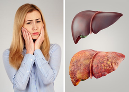 Những dấu hiệu cảnh báo cơ thể bạn cần phải giải độc