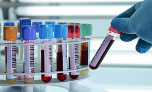 100 bệnh viện xét nghiệm miễn phí bệnh tan máu bẩm sinh cho thai phụ