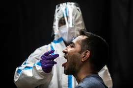 COVID-19 có thể khiến tinh trùng nam giới bị giảm chất lượng