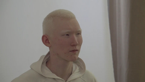 Video: Người mẫu mắc bệnh bạch tạng nổi tiếng ở Kazakhstan