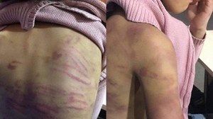Bé gái 12 tuổi nghi bị bạo hành, xâm hại tình dục: Cục Trẻ em lên tiếng