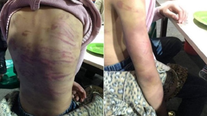 Bé gái 12 tuổi nghi bị bạo hành, xâm hại tình dục: Người mẹ nghiện ma túy