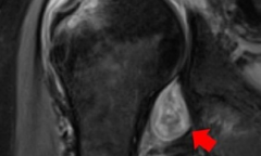 Chuyên gia Anh gợi ý cách có thể phát hiện người nghi mắc COVID-19