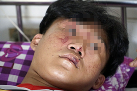 Ba học sinh ở Đồng Tháp bị nhóm người lạ vào tận trường lôi ra ngoài đánh dã man