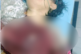 Truy bắt nghi phạm sát hại 2 phụ nữ ở Quảng Ninh