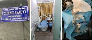  Báo động phẫu thuật thẩm mỹ chui ở TP.HCM 