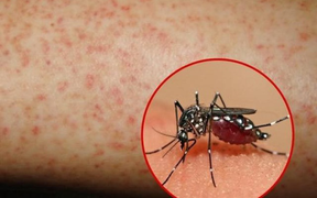 Mắc sốt xuất huyết, hai trẻ ở Phú Yên không qua khỏi