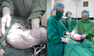 Bé gái sinh ra vẫn đang cựa quậy trong bọc ối