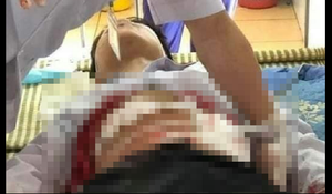 Học sinh lớp 9 đâm bạn trọng thương trong lúc trêu đùa