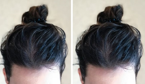 Tóc bết dầu phải làm sao để khắc phục?