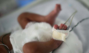 Ca siêu sinh gây 'choáng': Đẻ liền 9 con dù siêu âm chỉ ra 7