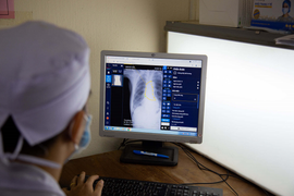 Bảo vệ thành trì chống dịch COVID -19 bằng đẩy mạnh ứng dụng AI trong y tế