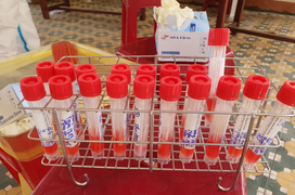 Đà Nẵng hỗ trợ Bắc Giang, Bắc Ninh 12.000 sinh phẩm xét nghiệm COVID-19