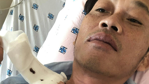 Nhiều sao Việt chia sẻ khi biết Hoài Linh bị ung thư tuyến giáp