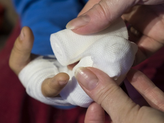 Bị xương cá đâm ngón tay, đầu bếp mất 2/3 cánh tay trái 