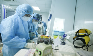 Thêm 87 ca mắc COVID-19 trong nước