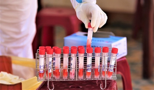 Có 5 ca dương tính SARS-CoV-2, Quảng Ngãi họp khẩn