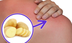 9 công dụng thần kỳ của khoai tây 