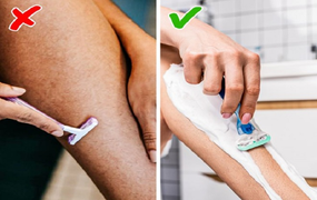 7 thói quen nguy hiểm làm hỏng tĩnh mạch khiến đôi chân xấu xí