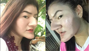 Cô gái khoe gương mặt với với chiếc mũi và cằm nhọn hoắt gây sốc dân mạng 