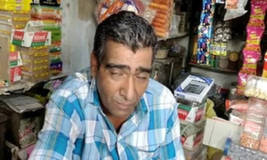 Mắc hội chứng hiếm gặp, người đàn ông ngủ li bì 300 ngày/năm