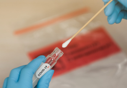 Anh xét nghiệm COVID-19 hàng ngày vì quá nhiều người phải cách ly