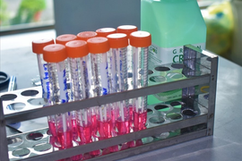 Cần biết: 16 loại test nhanh SARS-CoV-2 được Bộ Y tế cấp phép