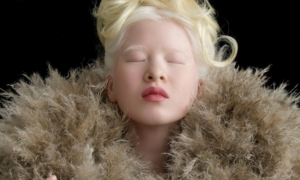 Vẻ đẹp kỳ lạ của người mẫu bạch tạng vốn là bé gái bị cha mẹ vứt bỏ