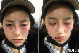 Cuộc sống địa ngục của những cô gái Hàn Quốc có bạn trai vũ phu