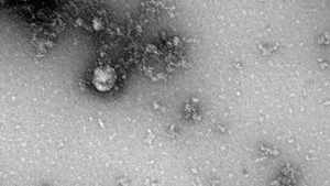 Virus corona đầu tiên xuất hiện cách đây 21.000 năm