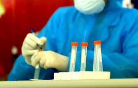 Trưa 6/9, Hà Nội thêm 38 người nhiễm SARS-CoV-2, 20 ca ở quận Thanh Xuân