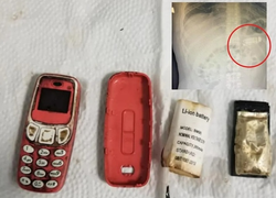 Nuốt chửng 'cục gạch' Nokia vào bụng, gã tù nhân suýt mất mạng