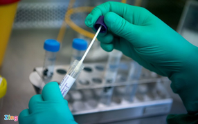 Đề xuất đưa kit xét nghiệm COVID-19 vào mặt hàng bình ổn giá