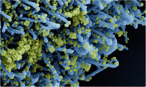 Phát hiện mới về hiệu quả của vaccine COVID-19 với biến chủng Delta