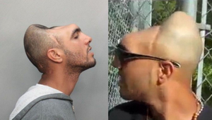 Chàng trai ‘không não’ nhưng vẫn sống khỏe suốt 20 năm một cách kỳ lạ