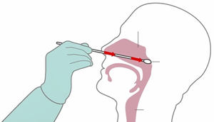 Video: Hướng dẫn lấy mẫu xét nghiệm COVID-19 tại nhà