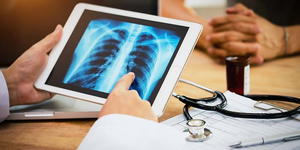 Ung thư phổi: Những yếu tố gây bệnh tiềm ẩn trong cuộc sống bạn không ngờ tới