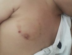 Bé gái 16 tháng tuổi ở Hải Phòng nghi bị bạo hành: Công an vào cuộc