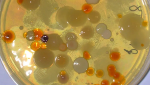 Độ lì kinh ngạc của vi khuẩn: Nhịn đói 1.000 ngày vẫn 'khỏe re'