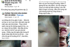 Đà Nẵng: Điều tra việc dân 'tố' bị đánh khi hỏi tiền hỗ trợ COVID-19