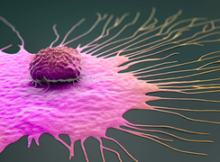 10 điều ‘sát sườn’ để ngăn ung thư phát triển: Cần phải làm ngay từ khi còn trẻ