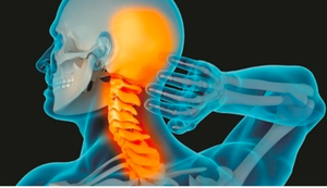 Bệnh thoái hóa đốt sống cổ 'tấn công' cả người trẻ: 4 việc nên làm để ngăn chặn