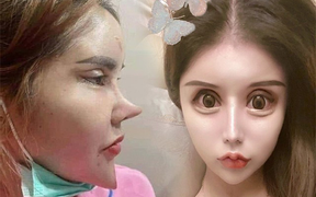 Hình ảnh cô gái 'dao kéo' quá đà gây hoang mang trên mạng xã hội