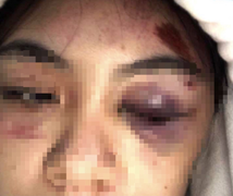 Nữ sinh bị đánh hội đồng ở Lâm Đồng: Tạm giữ hình sự 4 cô gái