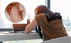 Ngồi 8 tiếng mỗi ngày: Nguyên nhân gây ra căn bệnh dễ tử vong ngay ít ai biết