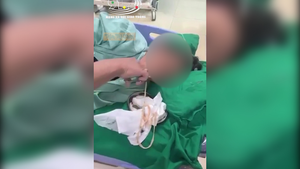 Video: Kinh hãi cảnh bác sĩ kéo con sán dài 3m từ miệng bệnh nhân 