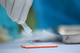 Cấp phép cho kit test COVID-19 của Việt Á, Bộ Y tế khẳng định 'đúng quy định'