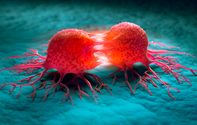 6 dấu hiệu cảnh báo ung thư sớm: Đi khám ngay có thể 'cứu' bạn khỏi án tử